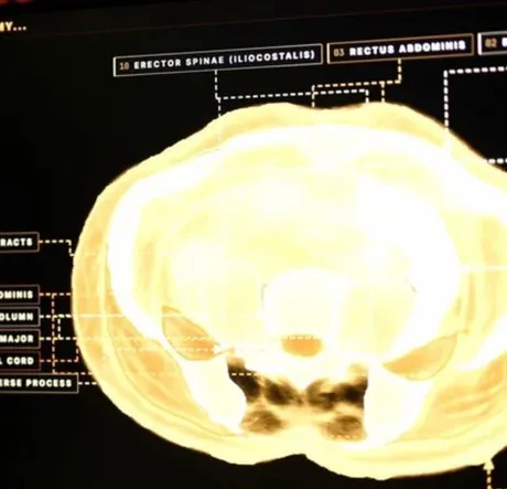 Scanare 3D a corpului uman cu detalii anatomice vizibile.