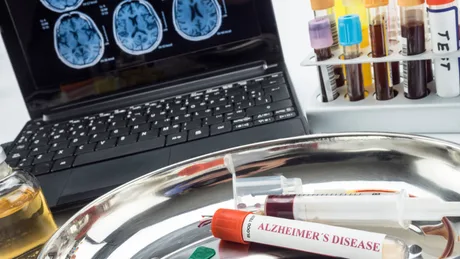 Echipamente medicale pentru diagnosticarea bolii Alzheimer.