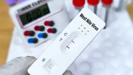 Test pentru virusul West Nile, utilizat în diagnosticare.