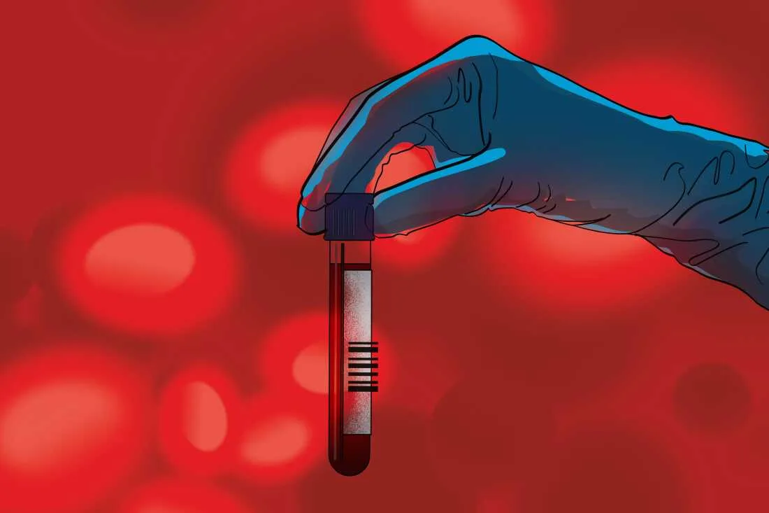 Test de sânge pentru depistarea cancerului, cu un tub de probă în mână.