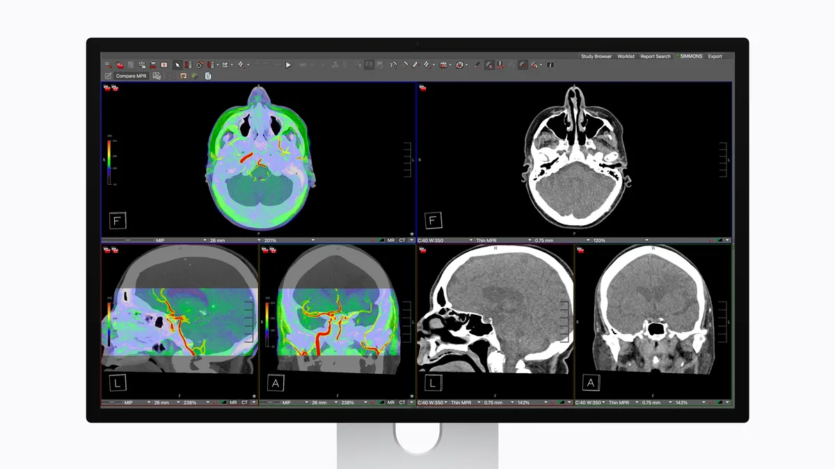 Monitor cu imagini medicale pentru editare profesională.